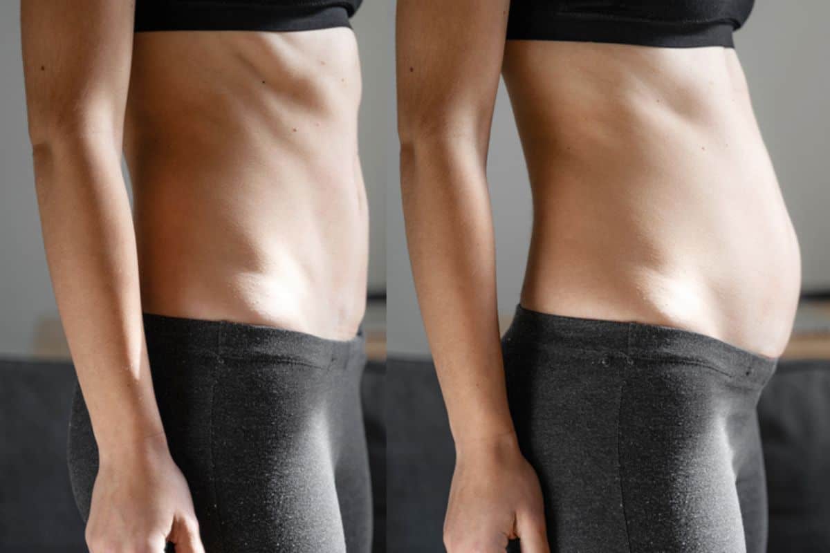 How long does diastasis recti take to improve Nottinghamshire?