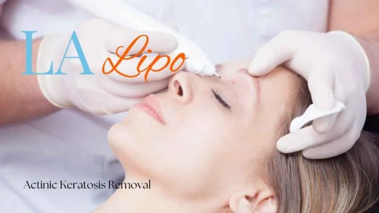 Woman receiving Actinic Keratosis Removal Treatment Nottinghamshire