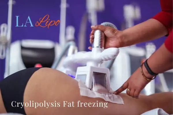 women getting fat freezing Nottinghamshire