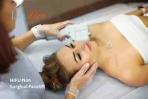 Woman having Hi-Fu to reduce wrinkles Nottinghamshire.