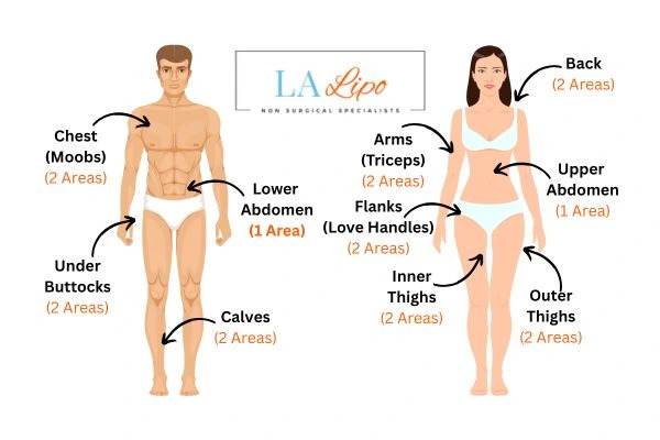 LA LIPO Cryolipolysis Areas Nottinghamshire