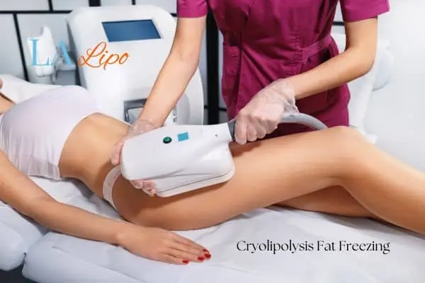Woman receiving coolsculpting Nottinghamshire treatment on her thighs