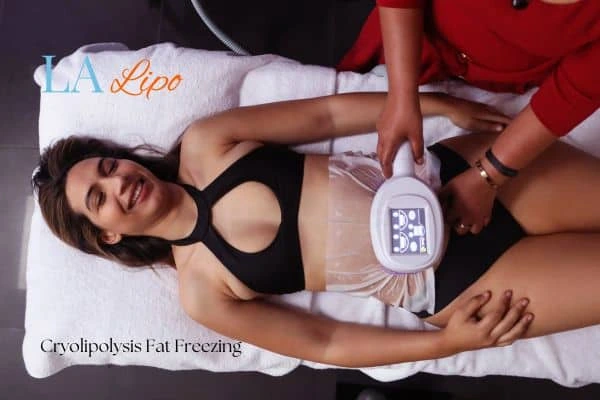 woman getting cryolipolysis Nottinghamshire