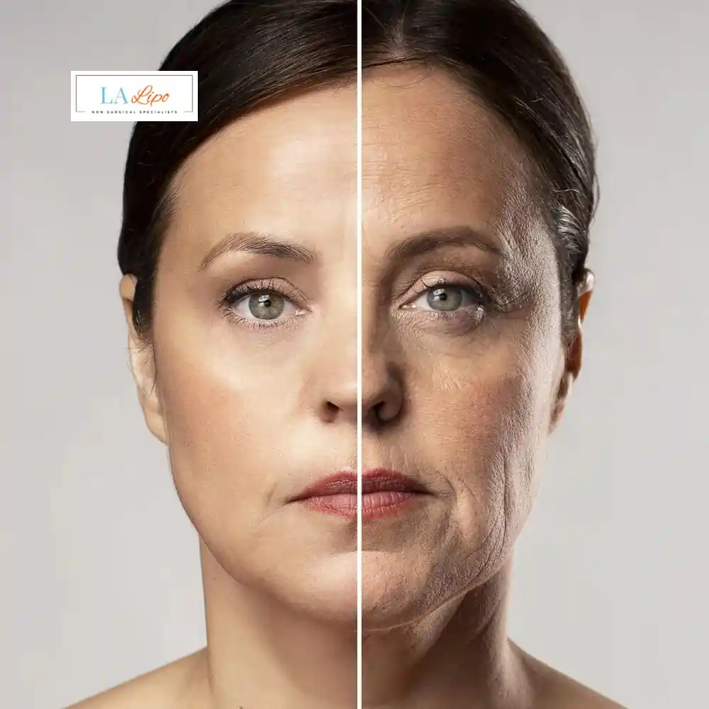 How Can You Tell If Non-Surgical Skin Tightening Is Right for You Nottinghamshire?