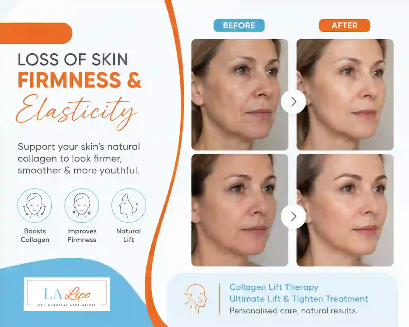 Sign #7: Loss of Skin Firmness and Elasticity Nottinghamshire