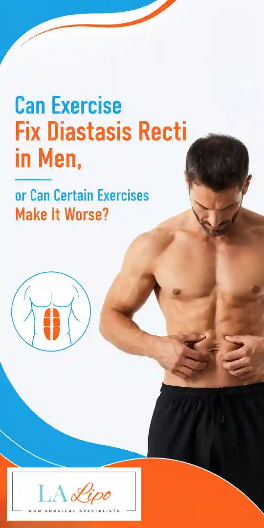 Can Exercise Fix Diastasis Recti in Men, or Can Certain Exercises Make It Worse Nottinghamshire?